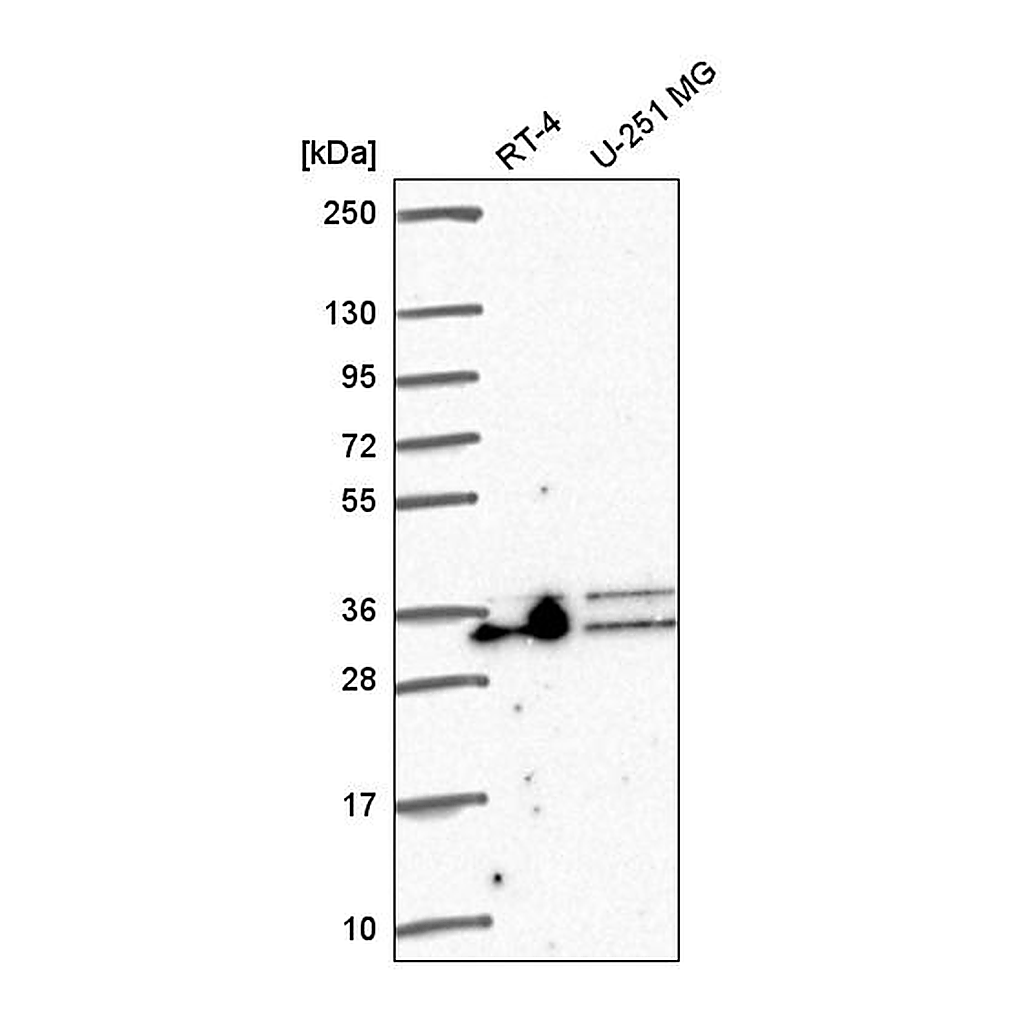 Atlas Antibodies Anti-ALYREF Antibody