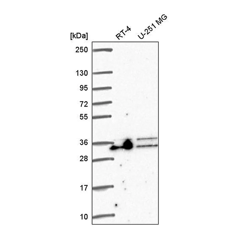 Atlas Antibodies Anti-ALYREF Antibody