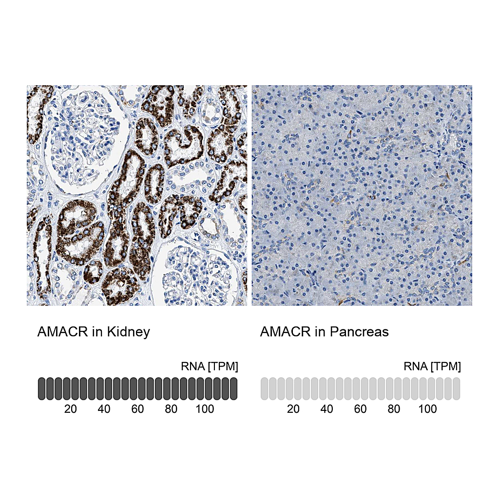 Atlas Antibodies Anti-AMACR Antibody