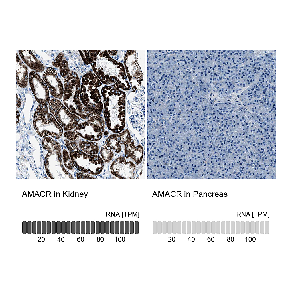 Atlas Antibodies Anti-AMACR Antibody