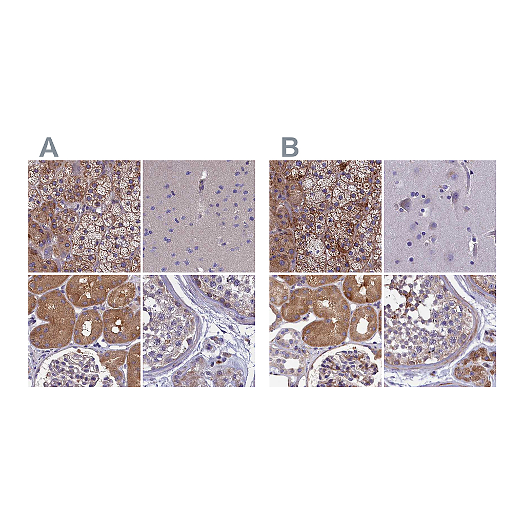 Atlas Antibodies Anti-AMDHD2 Antibody