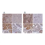 Atlas Antibodies Anti-AMDHD2 Antibody