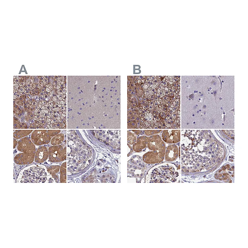 Atlas Antibodies Anti-AMDHD2 Antibody
