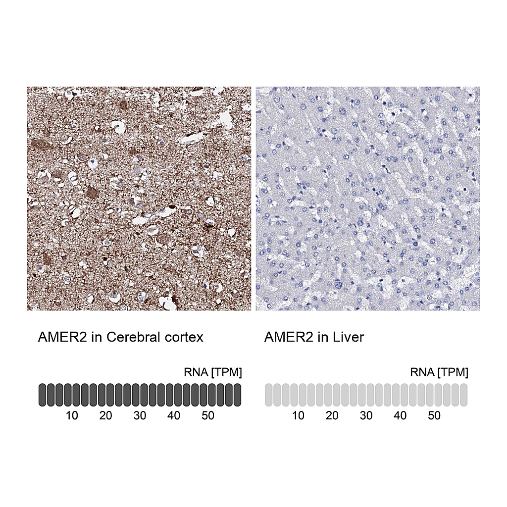 Atlas Antibodies Anti-AMER2 Antibody