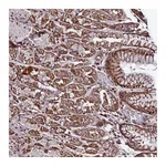 Atlas Antibodies Anti-AMER3 Antibody