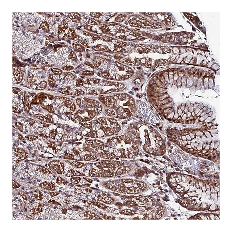 Atlas Antibodies Anti-AMER3 Antibody