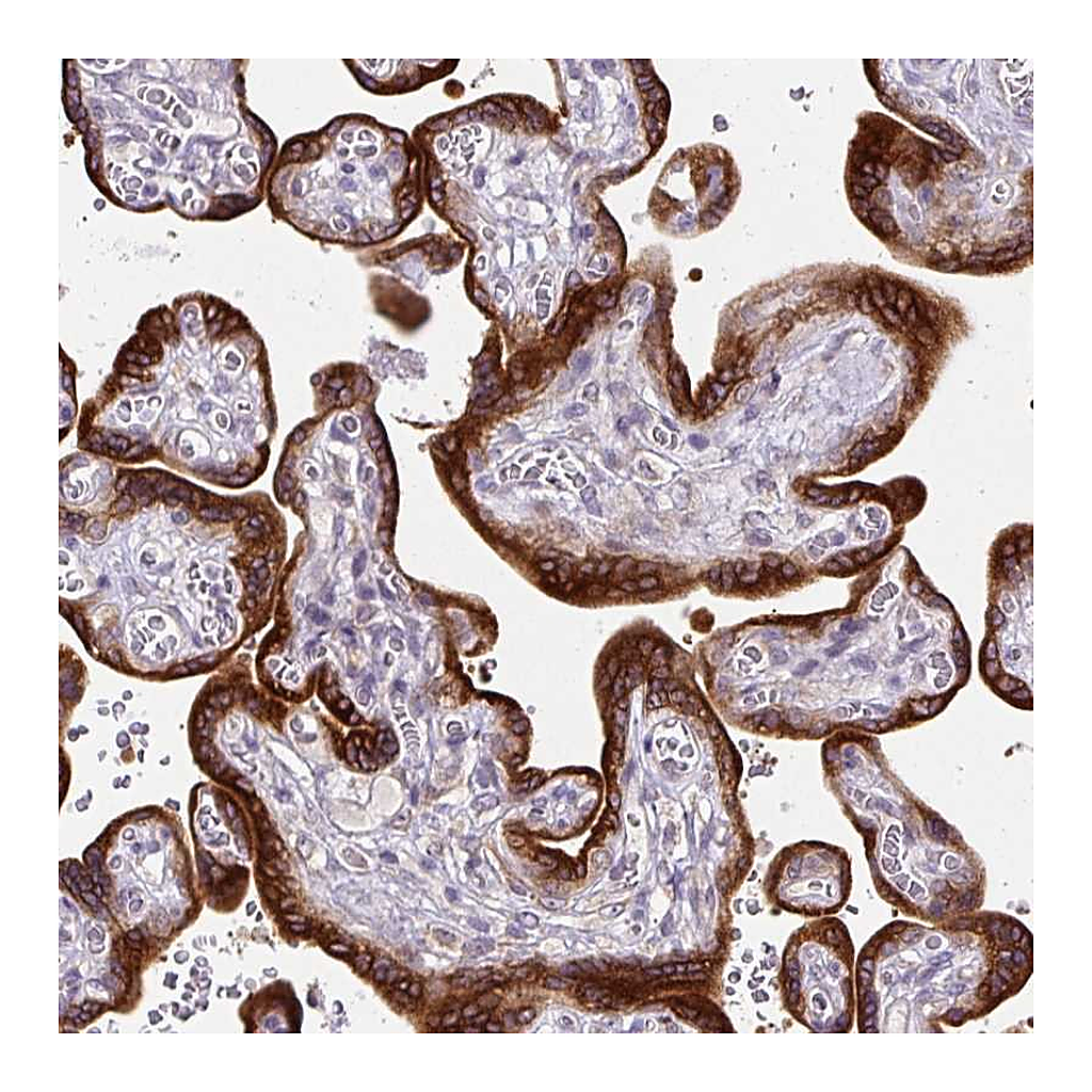 Atlas Antibodies Anti-AMFR Antibody