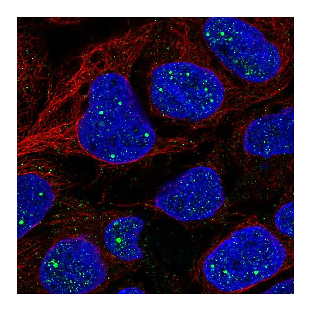 Atlas Antibodies Anti-AMER1 Antibody
