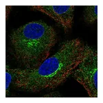 Atlas Antibodies Anti-AMFR Antibody