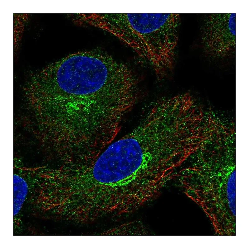 Atlas Antibodies Anti-AMFR Antibody