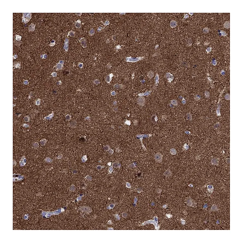 Atlas Antibodies Anti-AMN1 Antibody