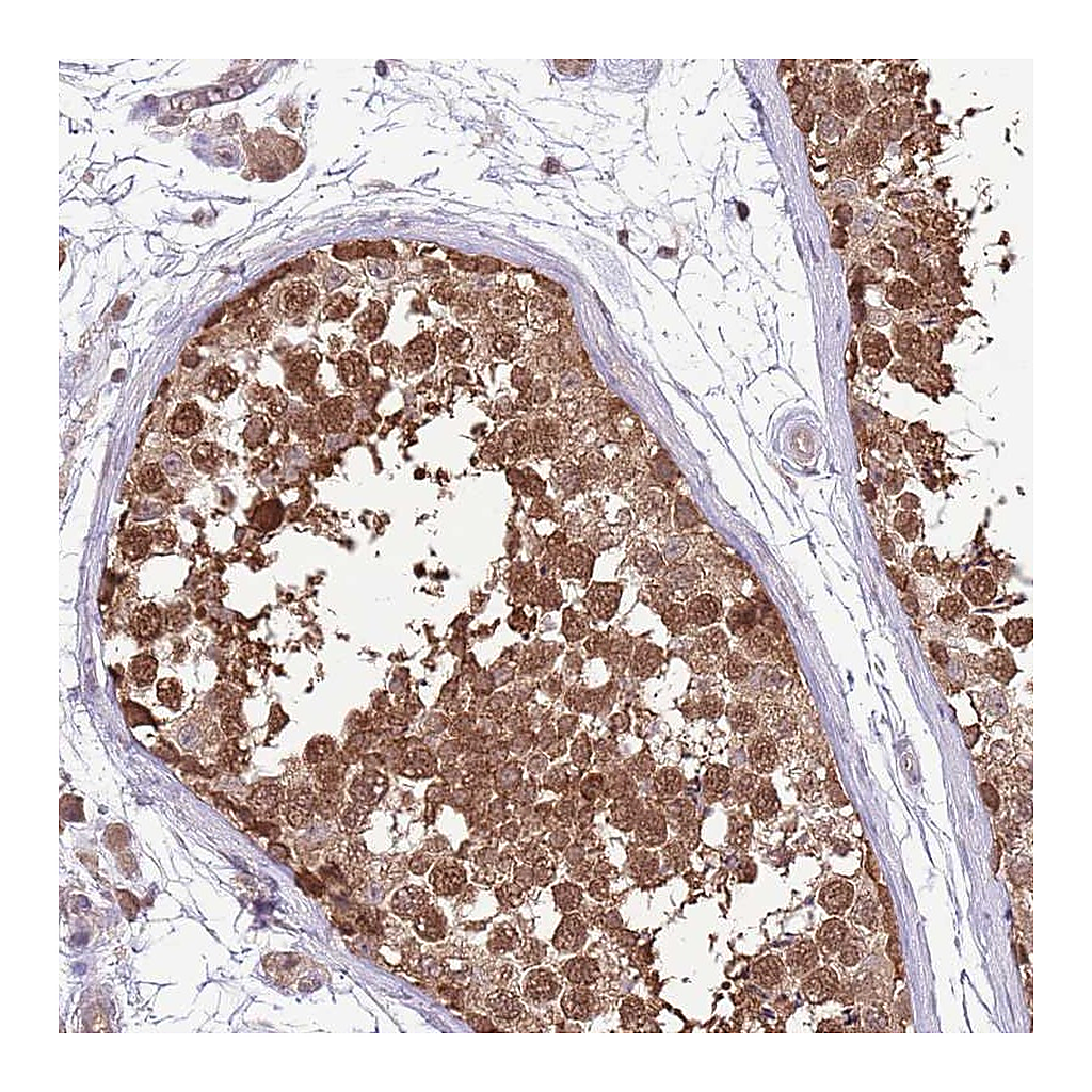 Atlas Antibodies Anti-AMIGO1 Antibody