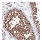 Atlas Antibodies Anti-AMIGO1 Antibody