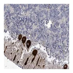 Atlas Antibodies Anti-AMMECR1 Antibody
