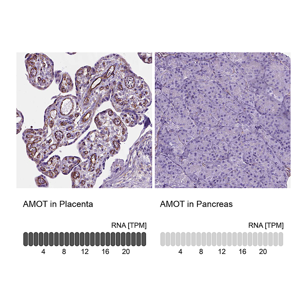 Atlas Antibodies Anti-AMOT Antibody