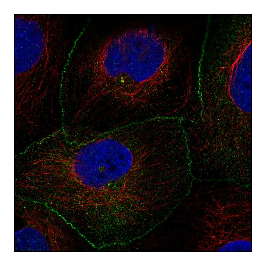 Atlas Antibodies Anti-AMOTL2 Antibody