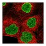 Atlas Antibodies Anti-AMPD3 Antibody