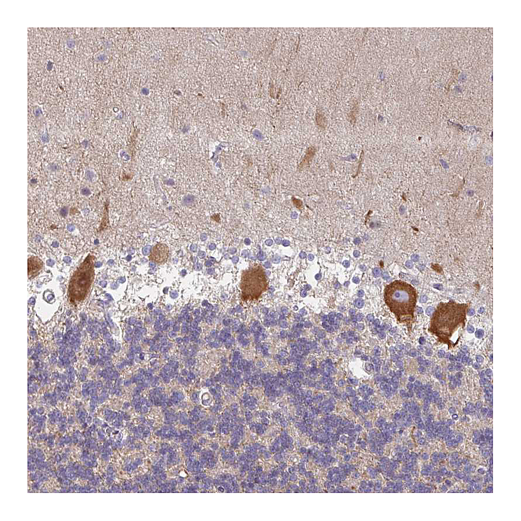 Atlas Antibodies Anti-AMPD2 Antibody