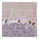 Atlas Antibodies Anti-AMPD2 Antibody