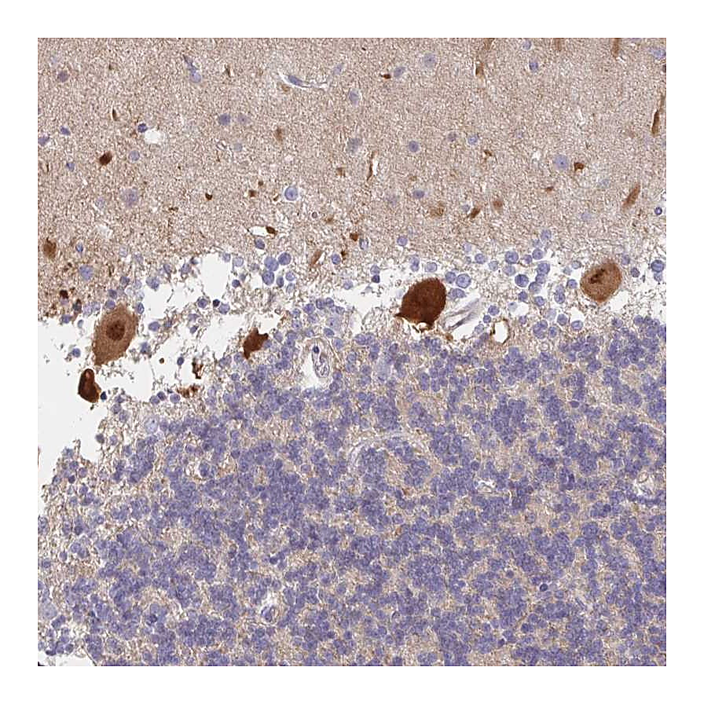 Atlas Antibodies Anti-AMPD2 Antibody