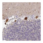 Atlas Antibodies Anti-AMPD2 Antibody