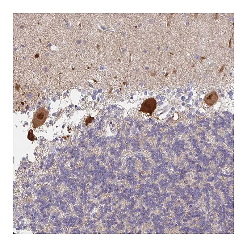Atlas Antibodies Anti-AMPD2 Antibody