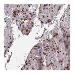 Atlas Antibodies Anti-AMPD3 Antibody