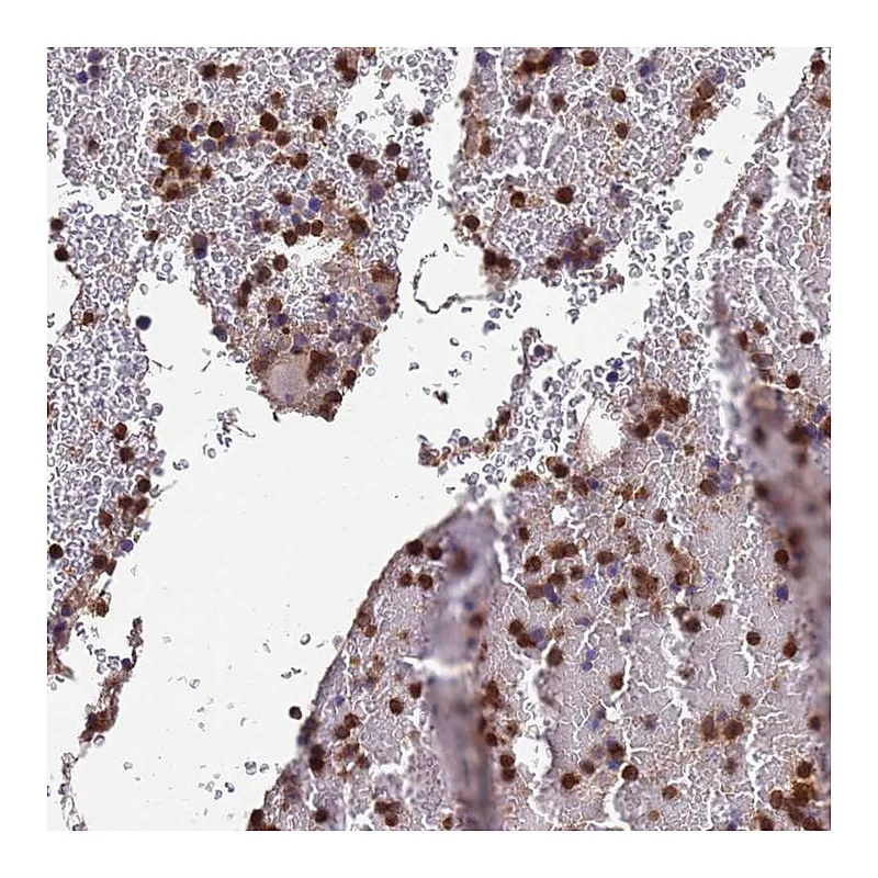 Atlas Antibodies Anti-AMPD3 Antibody