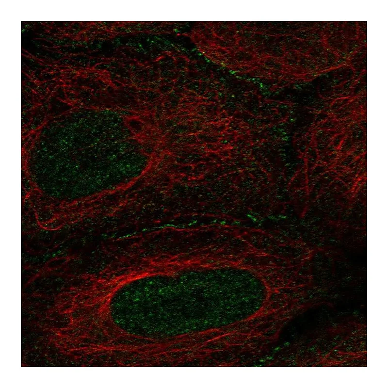 Atlas Antibodies Anti-AMOT Antibody