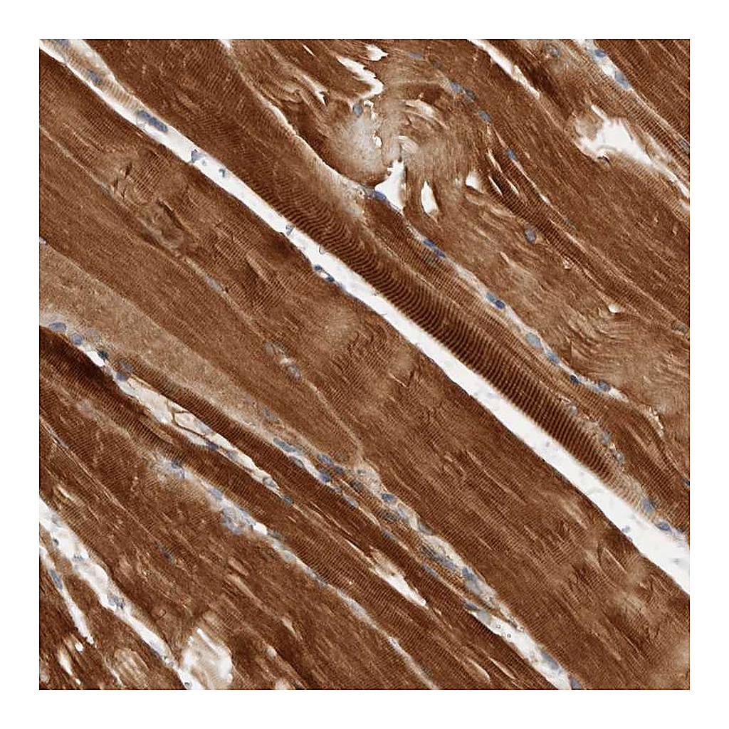 Atlas Antibodies Anti-AMPD1 Antibody