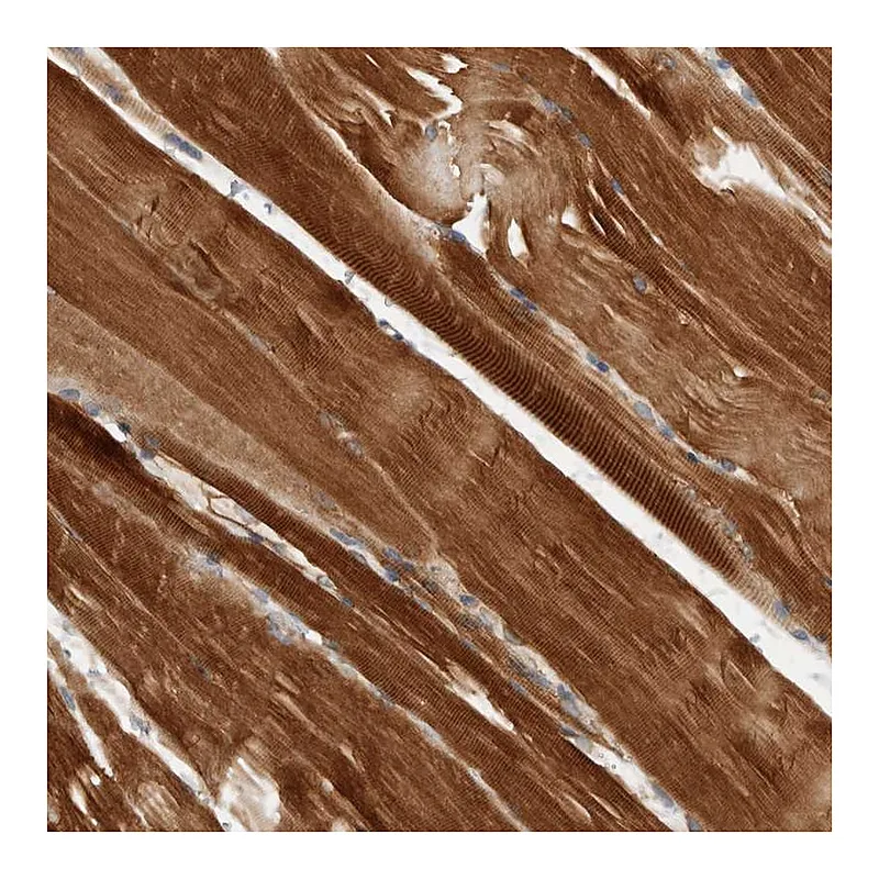 Atlas Antibodies Anti-AMPD1 Antibody