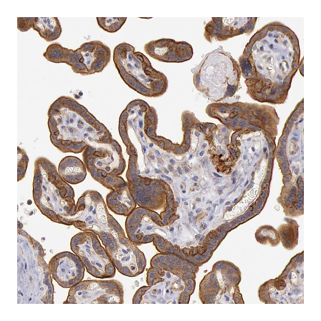 Atlas Antibodies Anti-AMOTL1 Antibody