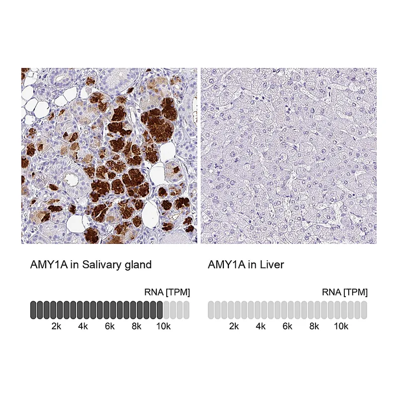 Atlas Antibodies Anti-AMY1A Antibody