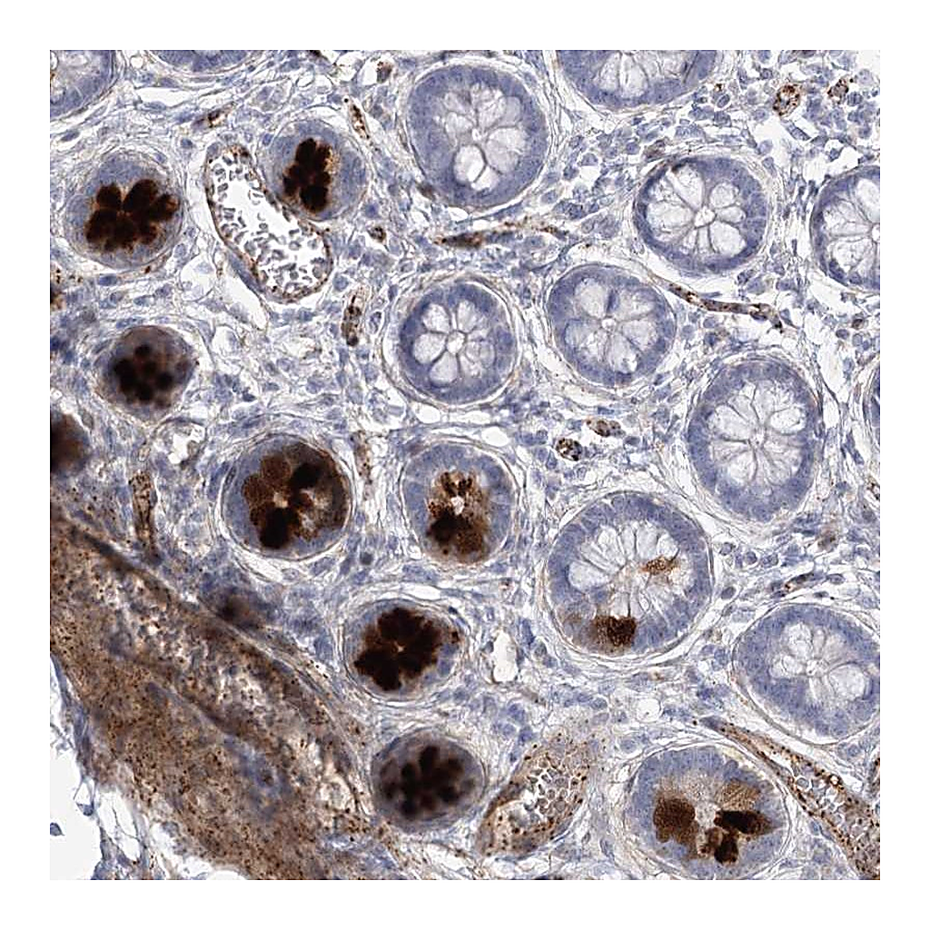 Atlas Antibodies Anti-AMTN Antibody