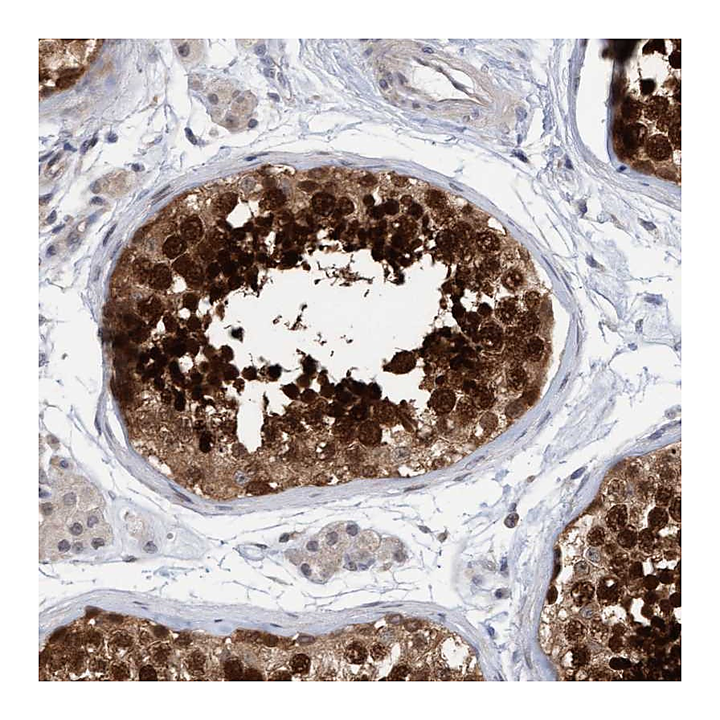 Atlas Antibodies Anti-AMZ2 Antibody