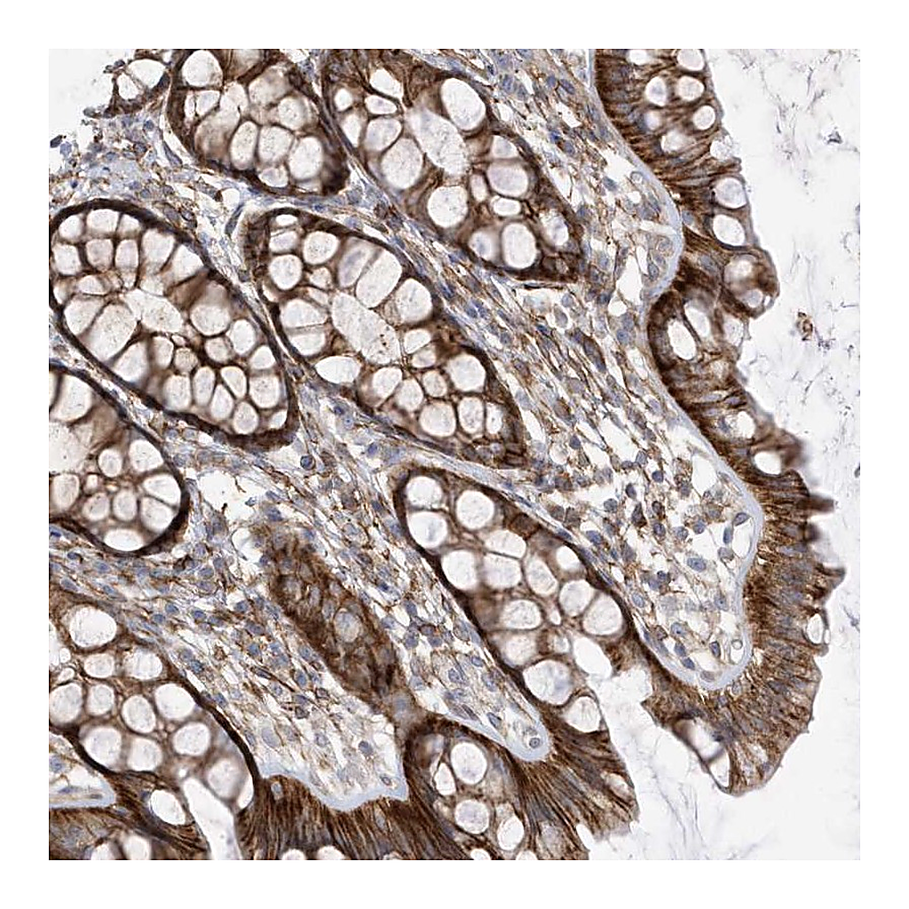 Atlas Antibodies Anti-ANAPC1 Antibody