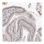 Atlas Antibodies Anti-ANAPC11 Antibody