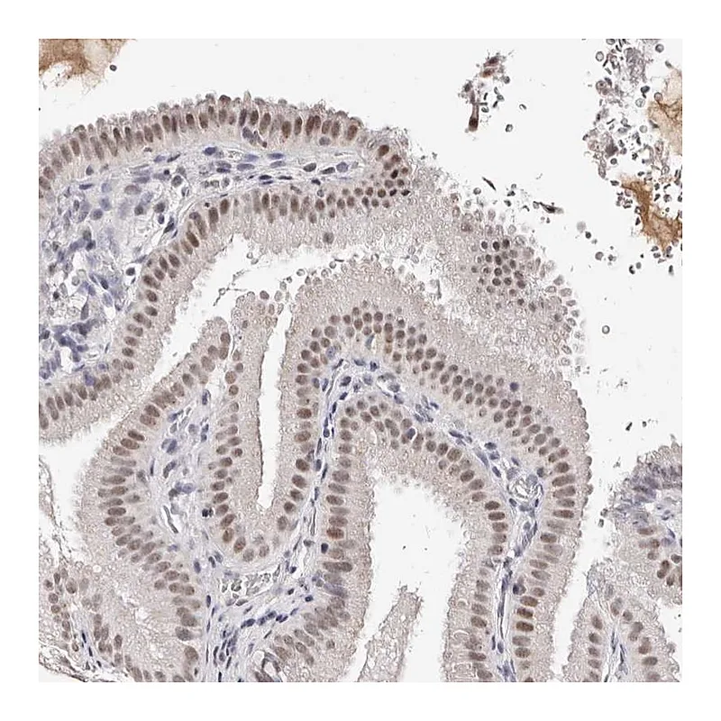 Atlas Antibodies Anti-ANAPC11 Antibody