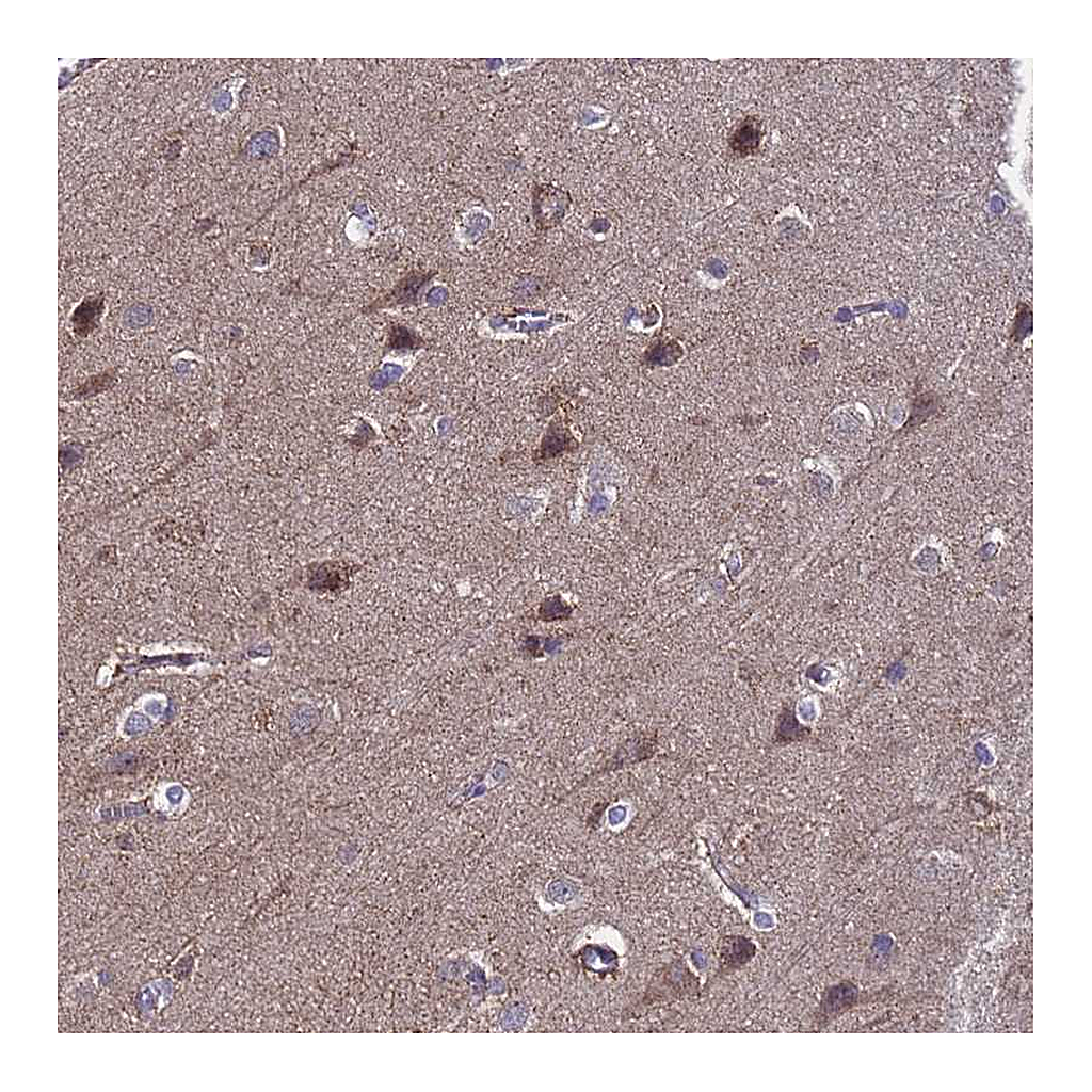 Atlas Antibodies Anti-ANAPC13 Antibody