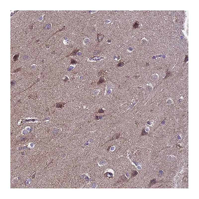 Atlas Antibodies Anti-ANAPC13 Antibody