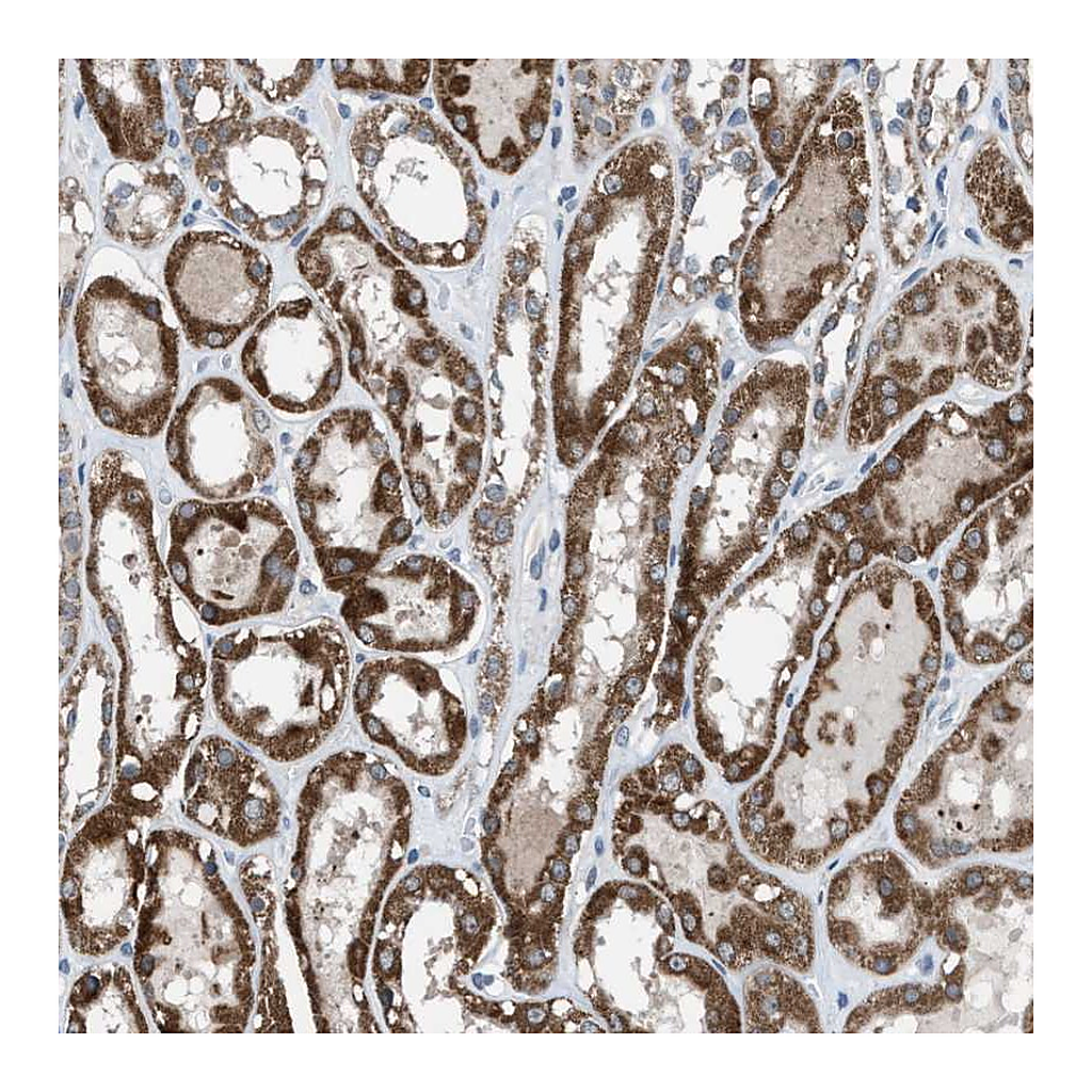 Atlas Antibodies Anti-ANAPC11 Antibody