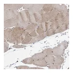 Atlas Antibodies Anti-ANAPC15 Antibody