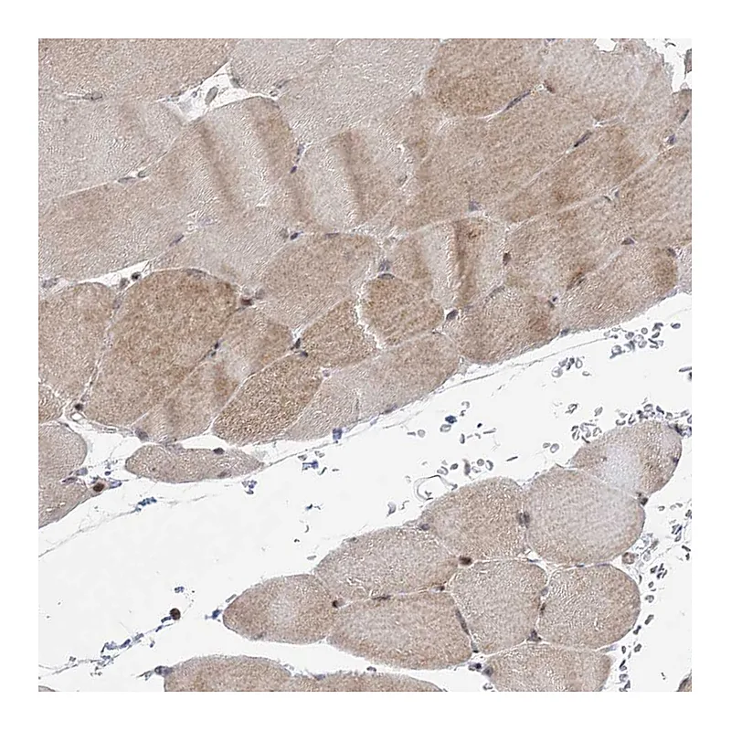 Atlas Antibodies Anti-ANAPC15 Antibody