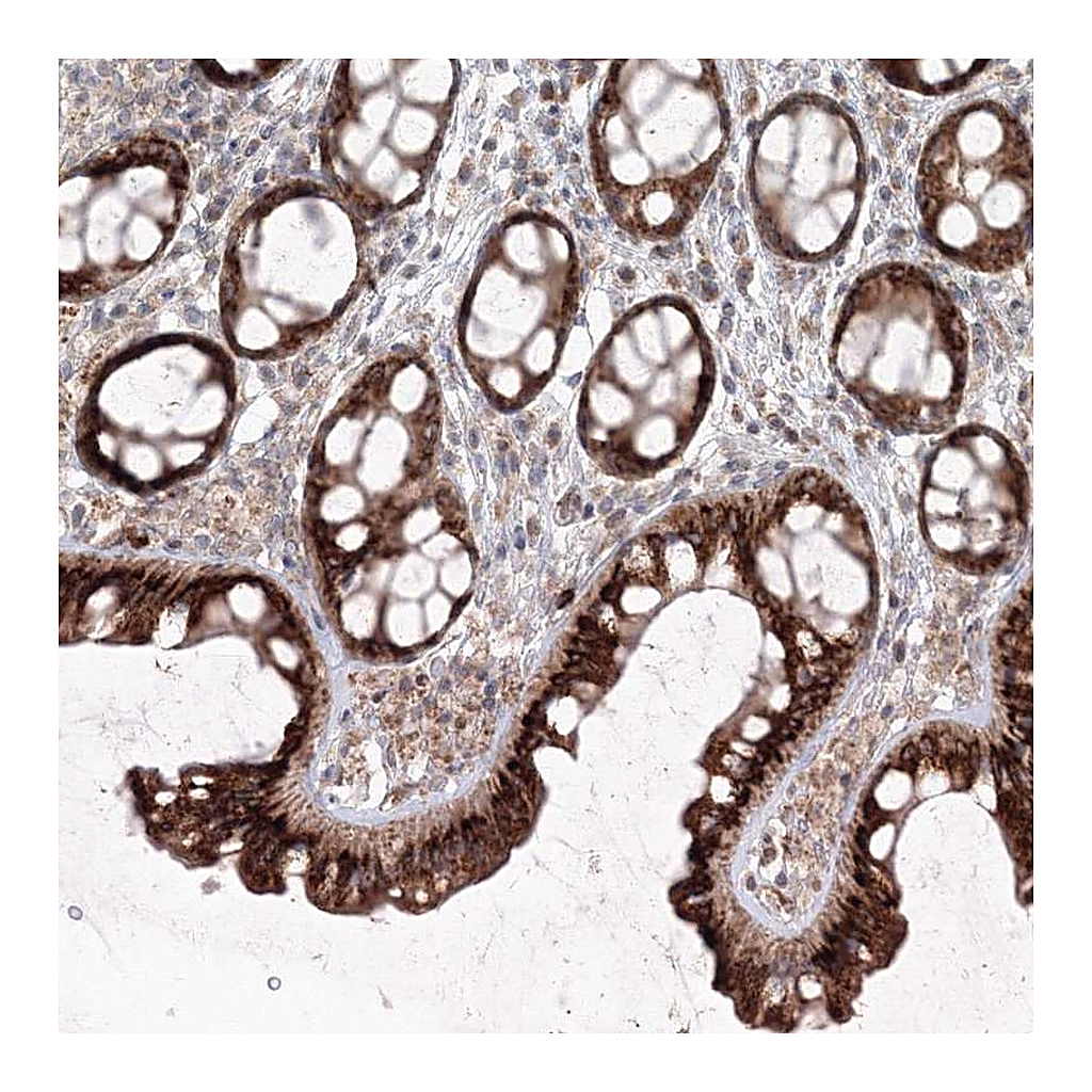 Atlas Antibodies Anti-ANAPC16 Antibody