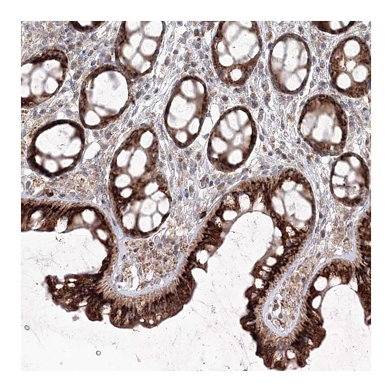 Atlas Antibodies Anti-ANAPC16 Antibody