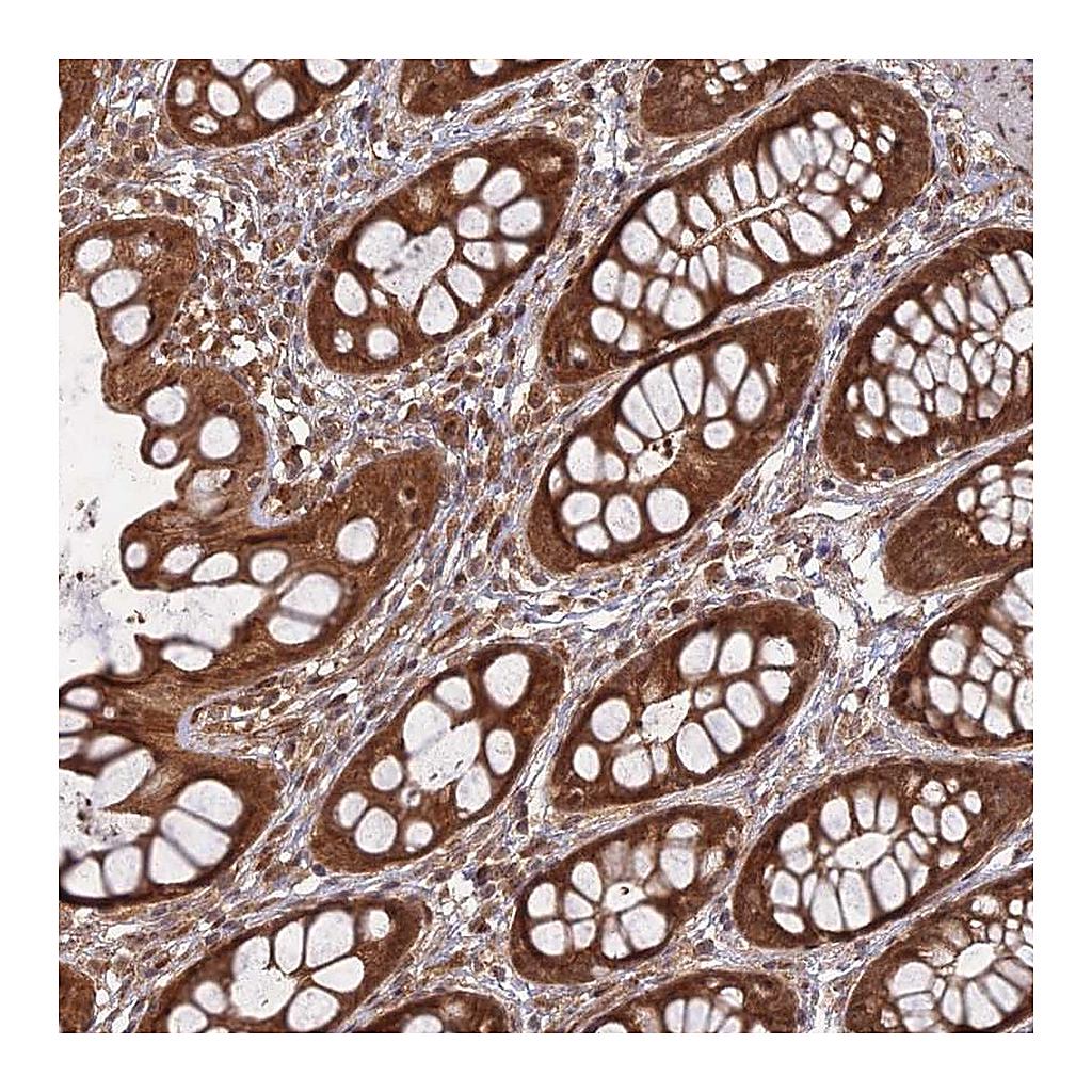 Atlas Antibodies Anti-ANAPC4 Antibody