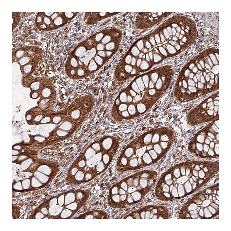Atlas Antibodies Anti-ANAPC4 Antibody