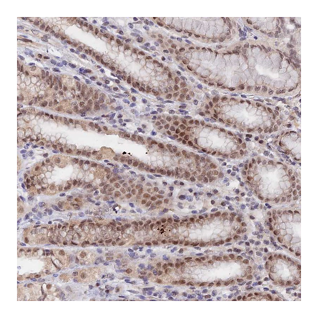 Atlas Antibodies Anti-ANAPC4 Antibody