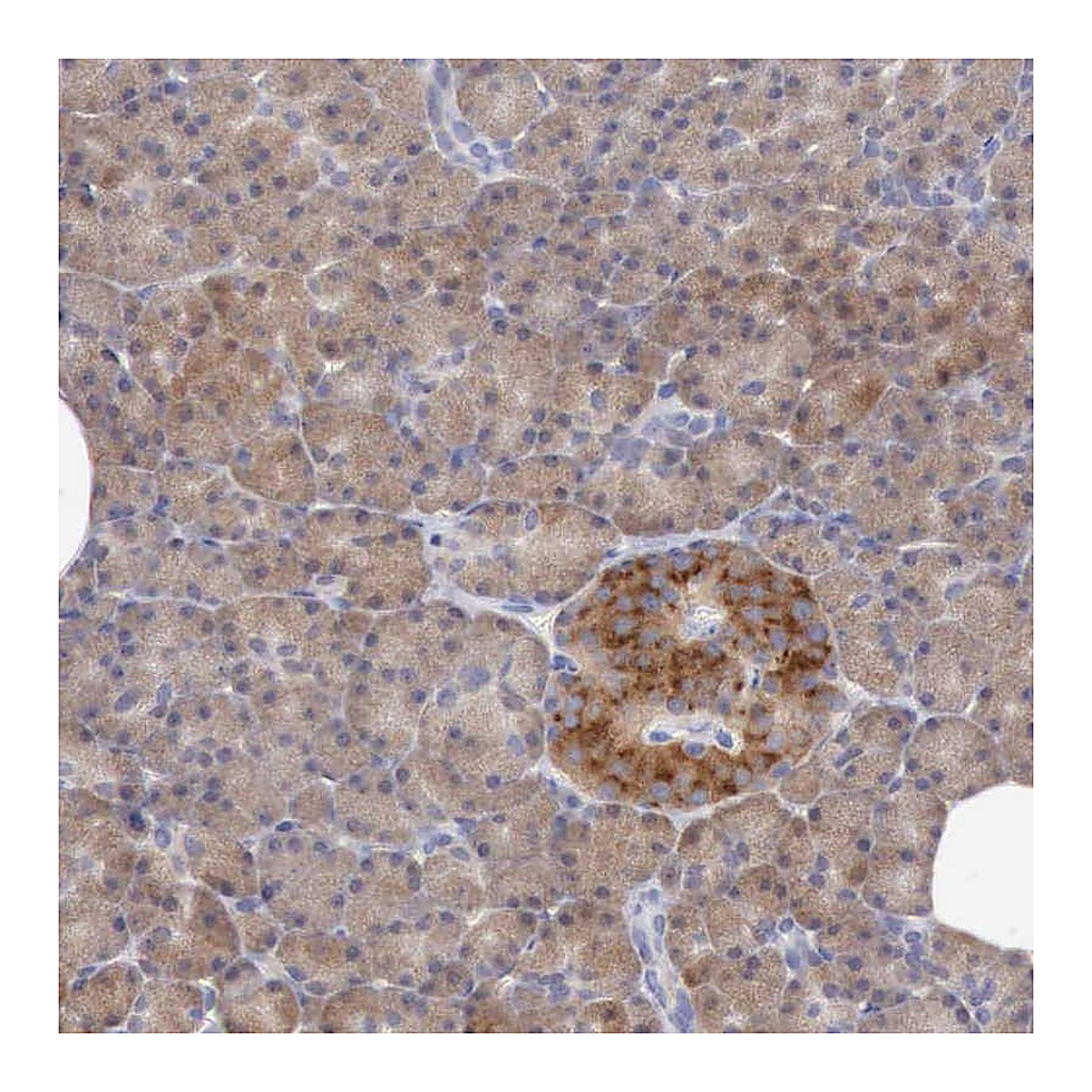 Atlas Antibodies Anti-ANGEL1 Antibody