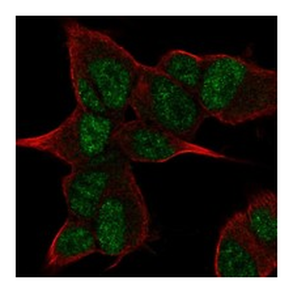Atlas Antibodies Anti-ANGEL2 Antibody